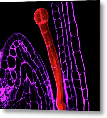 Embryo Structures Metal Prints