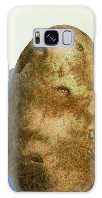 Potato Galaxy Cases