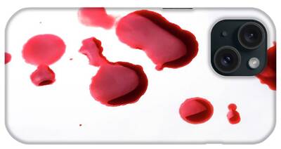 Blood Analysis iPhone Cases