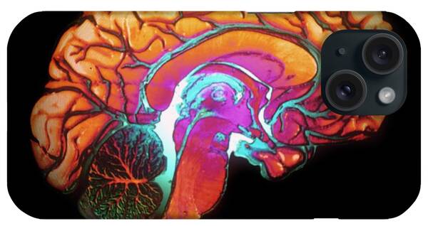 Designs Similar to Human Brain by Gjlp/cnri