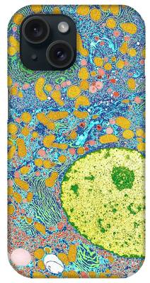 Liver Cell iPhone Cases