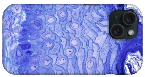 Stratified Squamous iPhone Cases