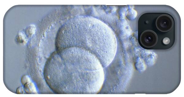 Embryogenesis iPhone Cases