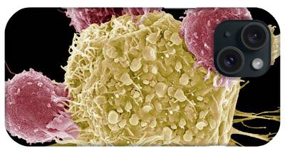 T-lymphocyte iPhone Cases