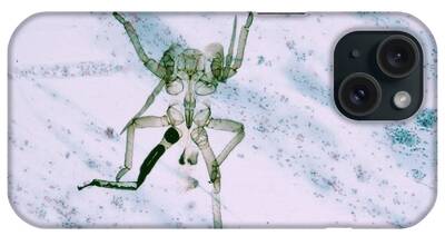 Pap Stain iPhone Cases