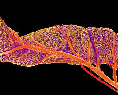 Duodenum Posters