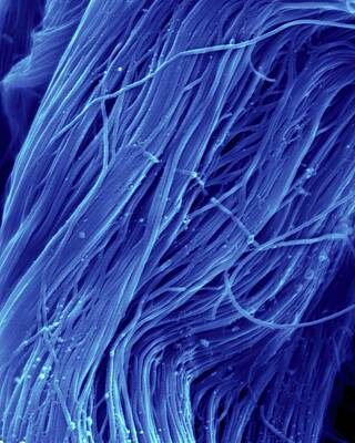 Horse Hair (equus Caballus) #2 by Dennis Kunkel Microscopy/science Photo  Library
