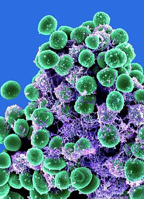 Staphylococcus Epidermidis Art