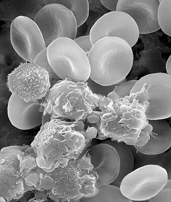 Blood Cells And Platelets Art