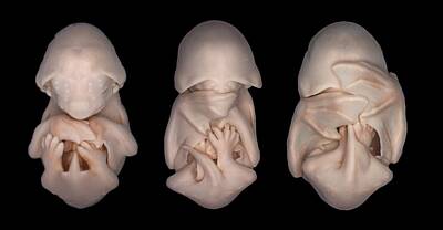Foetal Development Art