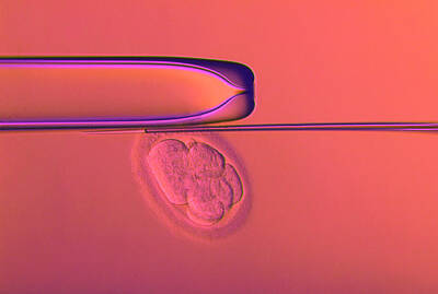 Designs Similar to Ivf Embryo Testing #8