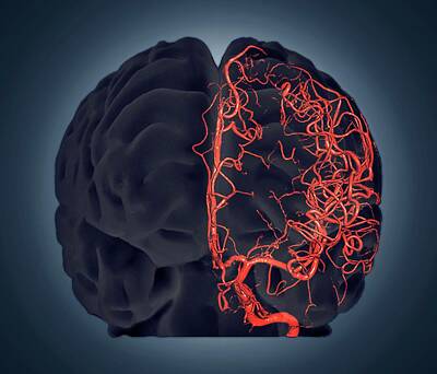 Designs Similar to Brain Vascular System #1