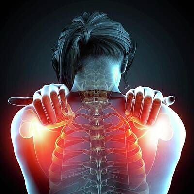 Designs Similar to Shoulder Pain #4