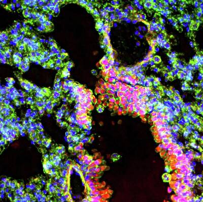 Bronchioles Art