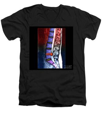 Magnetic Resonance Image V-Neck T-Shirts