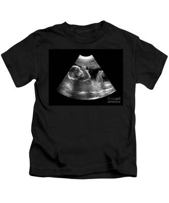 Amniotic Fluid Kids T-Shirts