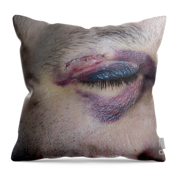 Sacroiliac Joint Throw Pillows for Sale - Fine Art America