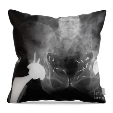 https://render.fineartamerica.com/images/rendered/search/throw-pillow/images-medium/double-hip-replacement-ted-kinsman.jpg