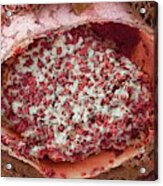 Blood Clot In The Lung #1 Acrylic Print