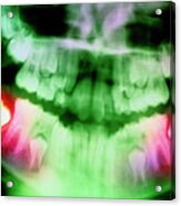 Colour Pan-oral X-ray Of Erupting Molars In Child #1 Acrylic Print