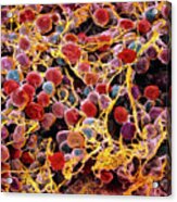 Coloured Sem Of Adipose Tissue Showing Fat Cells #1 Acrylic Print