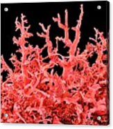 Lung Blood Vessels #1 Acrylic Print