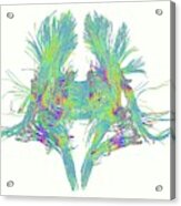 White Matter Fibres Of The Human Brain Acrylic Print