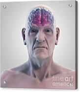 Geriatric Brain #8 Acrylic Print