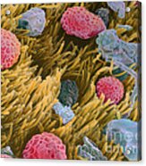 Allergens On Surface Of Trachea Acrylic Print