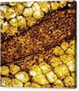 Artery And Fat Cells Acrylic Print