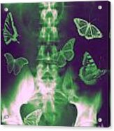 Butterflies In The Stomach Acrylic Print