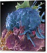 Hiv-infected And Normal T Cells Acrylic Print