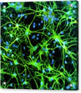 Immunofluorescent Lm Of Astrocyte Brain Cells Acrylic Print