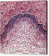 Stratified Squamous Epithelium, Lm Acrylic Print