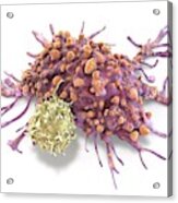 T Lymphocyte And Cancer Cell, Illustration Acrylic Print