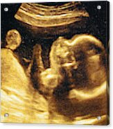 Ultrasound Of A Woman's Fetus At 37 Weeks Acrylic Print