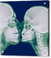 X-ray Kissing Acrylic Print
