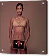 Young Woman Holding Tablet In Front Of Body To Show Womb & Ovaries Acrylic Print