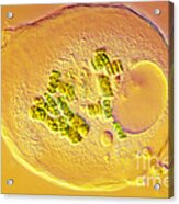 Amoeba Verrucosa #1 Acrylic Print