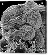 Methicillin-resistant Staphylococcus #34 Acrylic Print