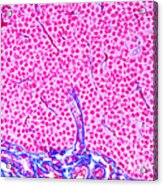 Parathyroid Gland Ts Acrylic Print