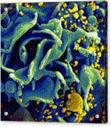 Hiv-infected T Cell, Sem Acrylic Print
