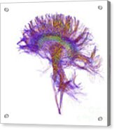 Brain, Fiber Tractography Image #2 Acrylic Print