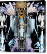 Skeletonism Acrylic Print