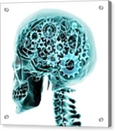 Blue X-ray Of The Brain And Skull With Acrylic Print