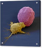 Killer Cell And Cancer Cell Acrylic Print