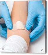 Doctor In Blue Rubber Protective Gloves Putting An Adhesive Bandage On Young Woman's Arm Vein After Blood Test Or Injection Of Vaccine. First Aid. Medical, Pharmacy And Healthcare Concept. Closeup. #1 Acrylic Print