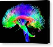 Colorful Brain Visualization Canvas Print