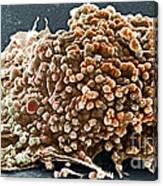 Cancer Cell #1 Canvas Print