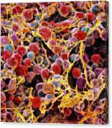 Coloured Sem Of Adipose Tissue Showing Fat Cells Canvas Print
